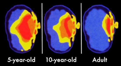 Are Cell Phones and Headphones Affecting Your Child’s Brain? - RadiArmor