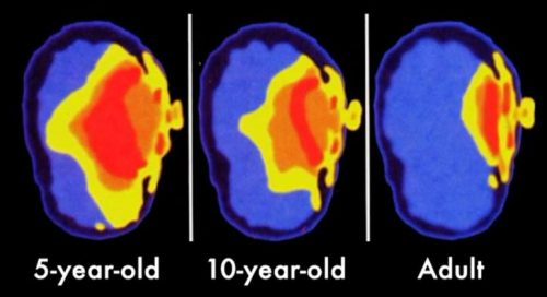 How cell phones affect your child’s brain